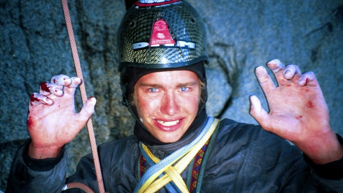 Leo-Houlding-Injury-Cerro-Torre